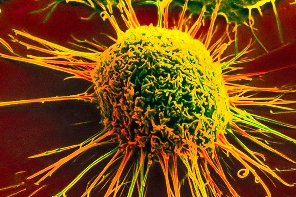 Исследователи изучили культуры раковых клеток, собранных у 600 пациентов с различными диагнозами