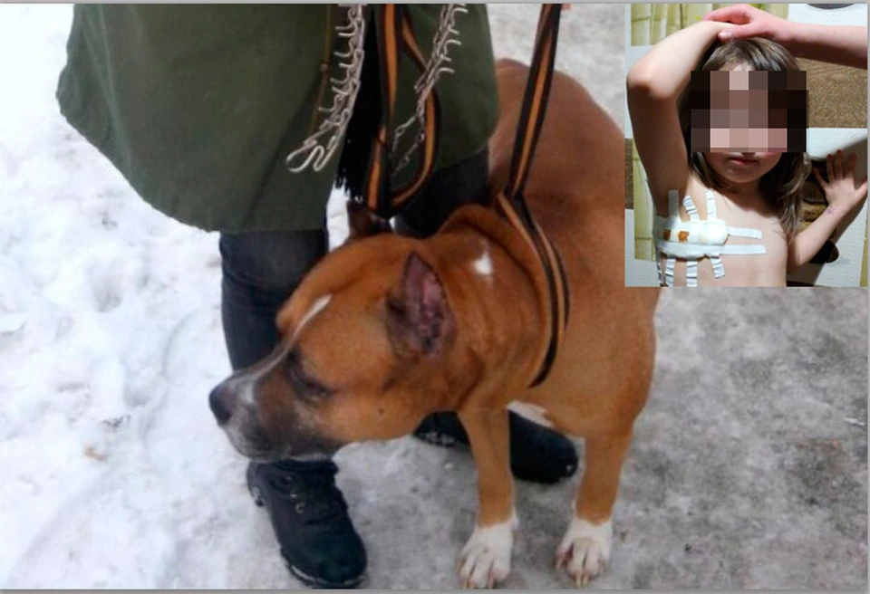 В Екатеринбурге домашний разъяренный пес напал на 4-летнего ребенка и разорвал ему подмышку