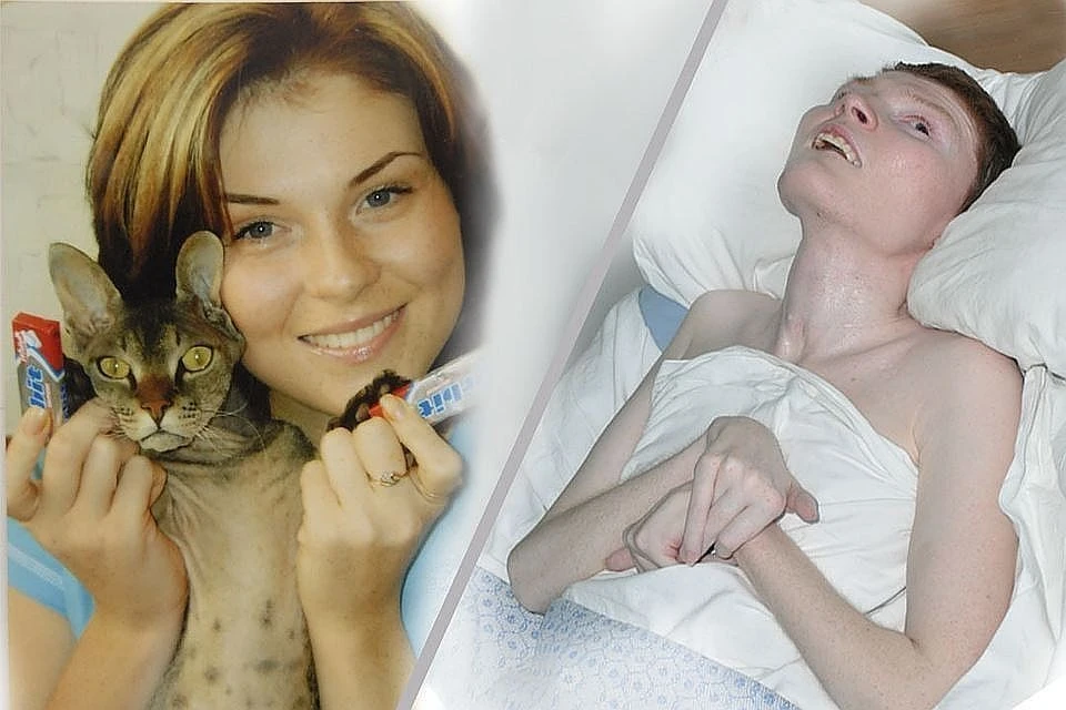 Ирина Пекарская - одна из самых тяжелых пострадавших в ночном клубе «Хромая лошадь»
