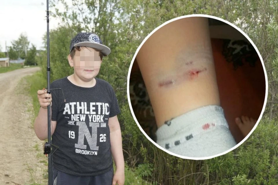 Мальчишка с окровавленной ногой чудом сумел вырваться и добежать до школы. Фото: личный архив.