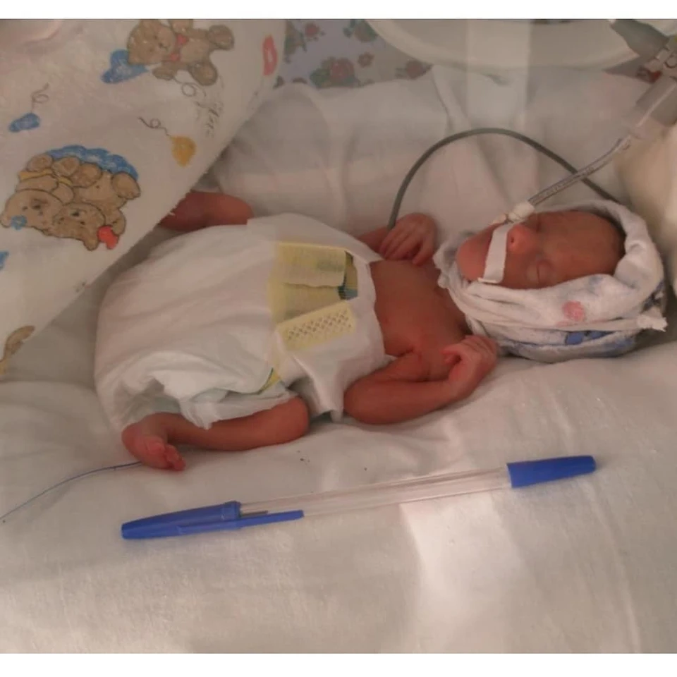 Вот такой маленькой родилась девочка в Бурятии в октябре 2019 года. Фото: Минздрав Бурятии.