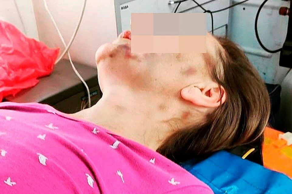 По словам подруги жертвы, в ночь, когда женщину привезли в больницу, у нее остановилось сердце