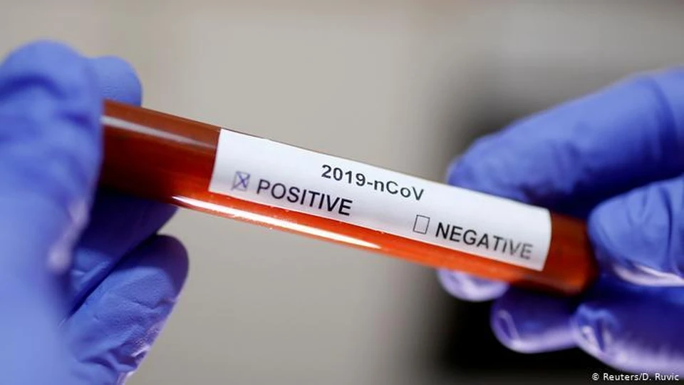 Тест на коронавирус в Молдове может подешеветь (Фото: reuters).