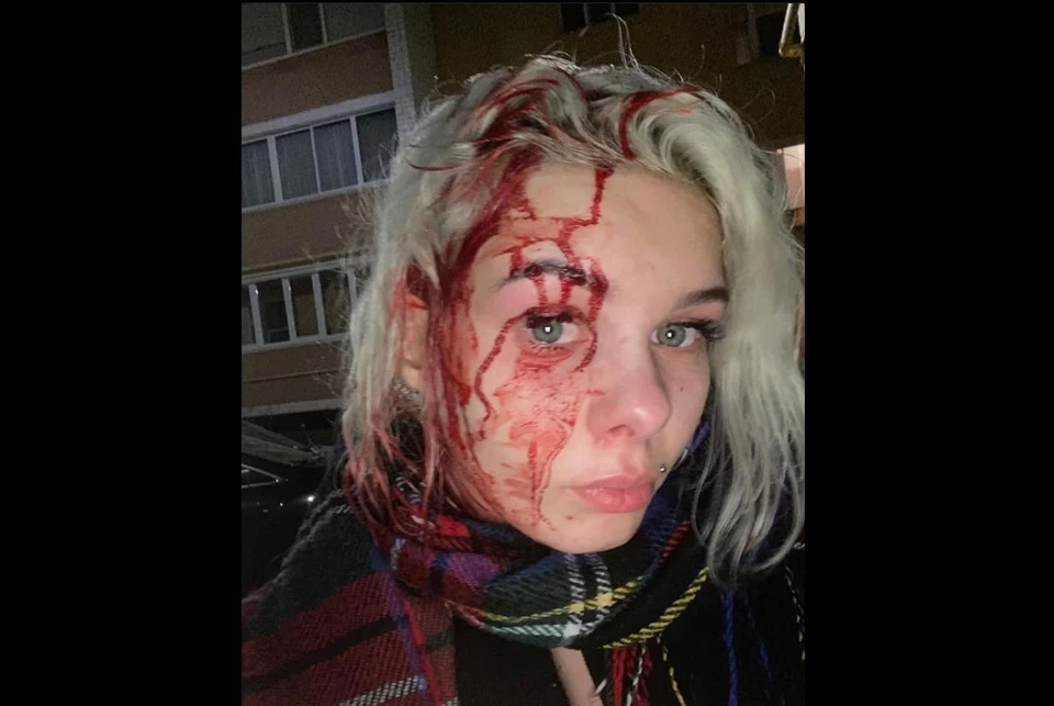 Фото: предоставлено пострадавшей.
