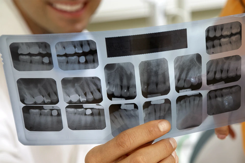 Многие рентгенологи в регионах нынче сутками работают со снимками легких, теперь им не до зубов.