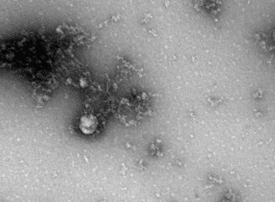 Учеными Роспотребнадзора получено первое изображение британского штамма нового коронавируса. Фото: сайт Роспотребнадзора