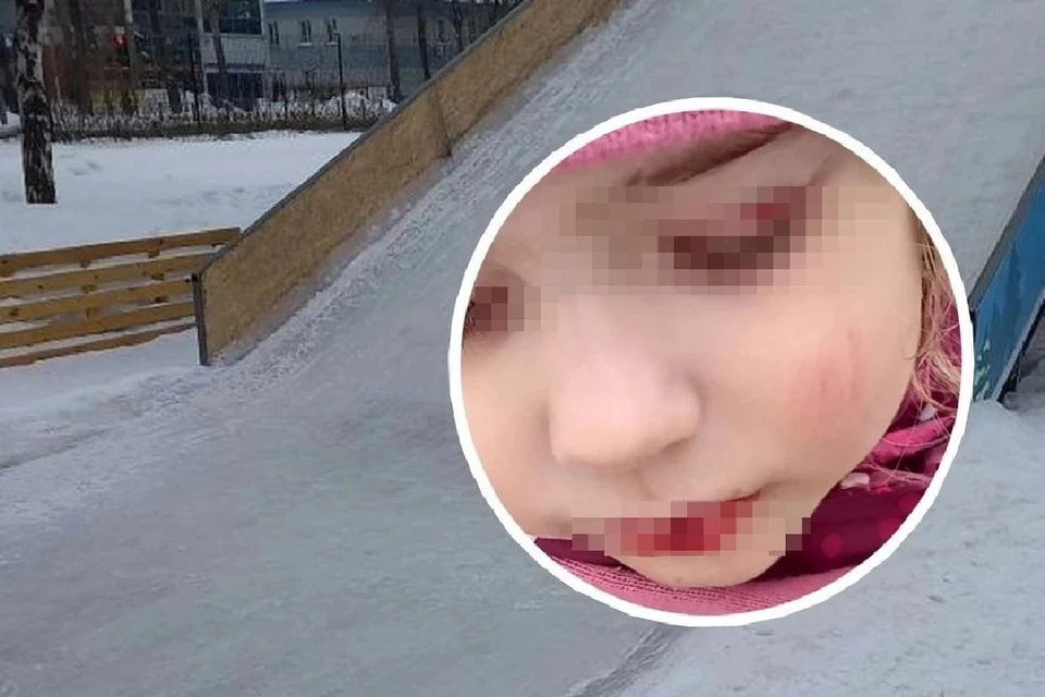 Девочка получила травмы, скатившись с горки. Фото: "Инцидент Новосибирск".