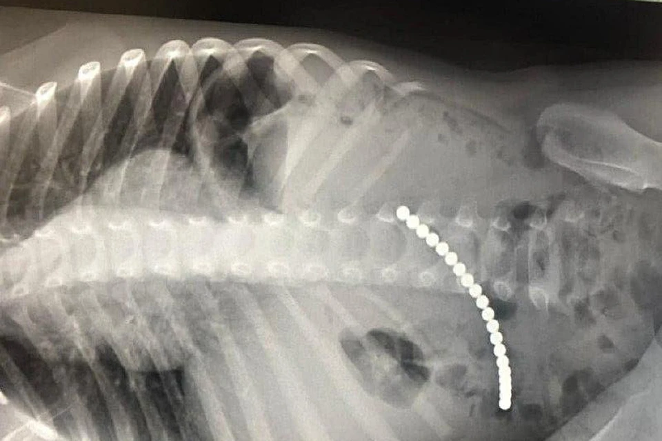 На снимке врачи заметили странную цепочку в кишечнике Димы. Стали разбираться и оказалось, что это магниты, которые мальчик проглотил во время игры. Фото: Департамент здравоохранения Московской области