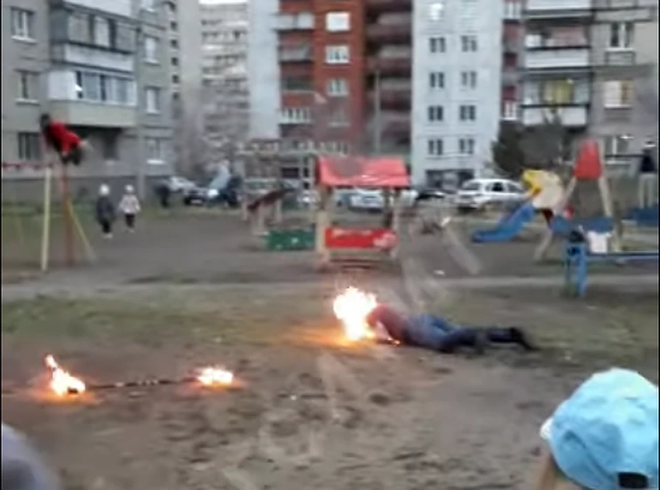 Мужчина был госпитализирован с ожогами. Фото: кадр из видео