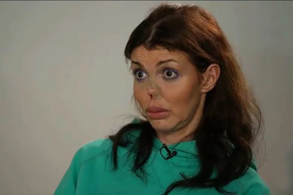 Проблемы со здоровьем продолжают преследовать Алису Аршавину. Фото: кадр видео.