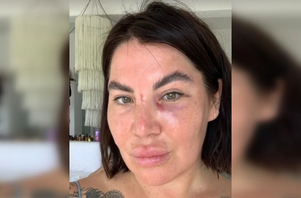 Пострадавшая решила не писать заявление на обидчиков . Фото: Instagram radarusskikh