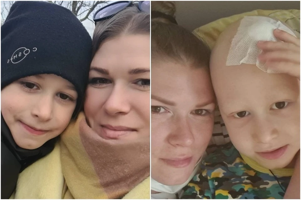 До и во время болезни. Фото: instagram.com/sergei_dobrenkov