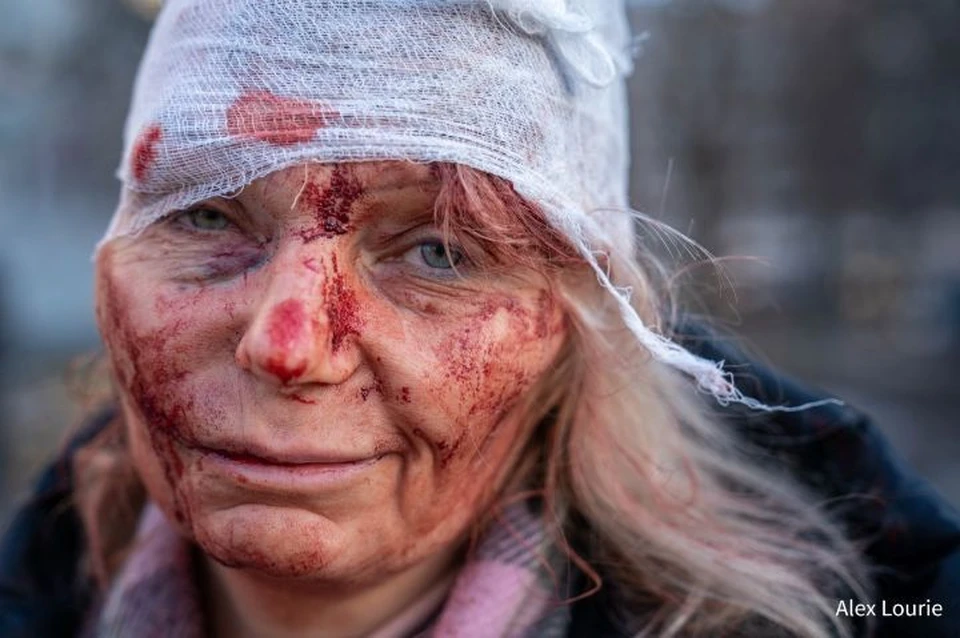 Фото этой якобы пострадавшей женщины облетело многие иностранные СМИ. ФОТО: страница Ильи Дианова