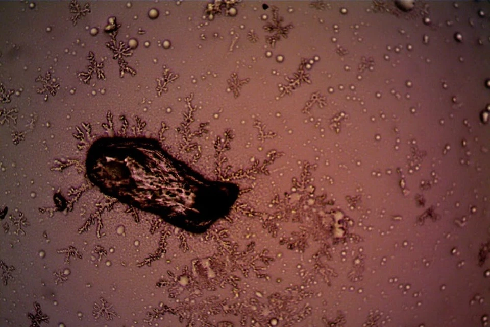 От микробиома в кишечнике в раннем детстве зависит популяции клеток, которые потом будут вырабатывать инсулин на протяжении всей жизни. Фотоиллюстрация: pexels.com