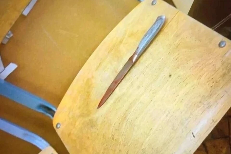 В Химках пятиклассница изрезала ножом свою подругу из-за мальчика Фото: соцсети