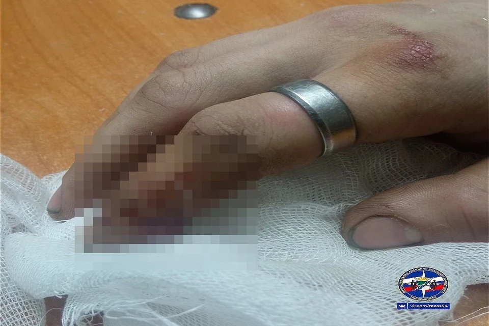 В Новосибирске спасатели при помощи дрели сняли массивное кольцо с раздутого пальца подростка. Фото: МАСС.