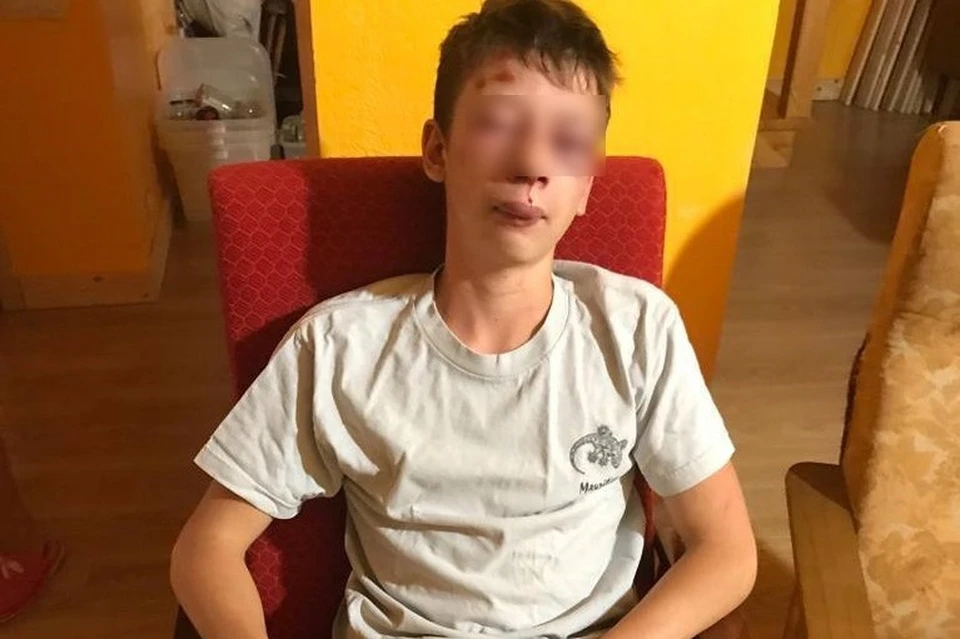 Полиция возбудила уголовное дело об избиении 15-летнего юноши из Пронска. Подозреваемые - двое взрослых мужчин. Фото: www.rzn.info