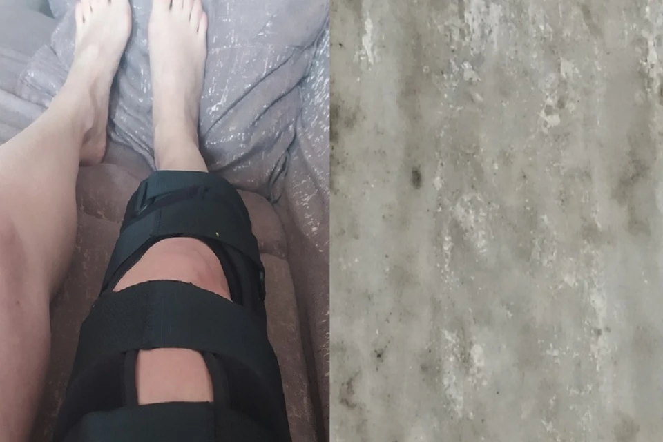 Жительница Новосибирска сломала ногу и порвала мениск, поскользнувшись на гололеде у подъезда. Фото: предоставлено героиней публикации.