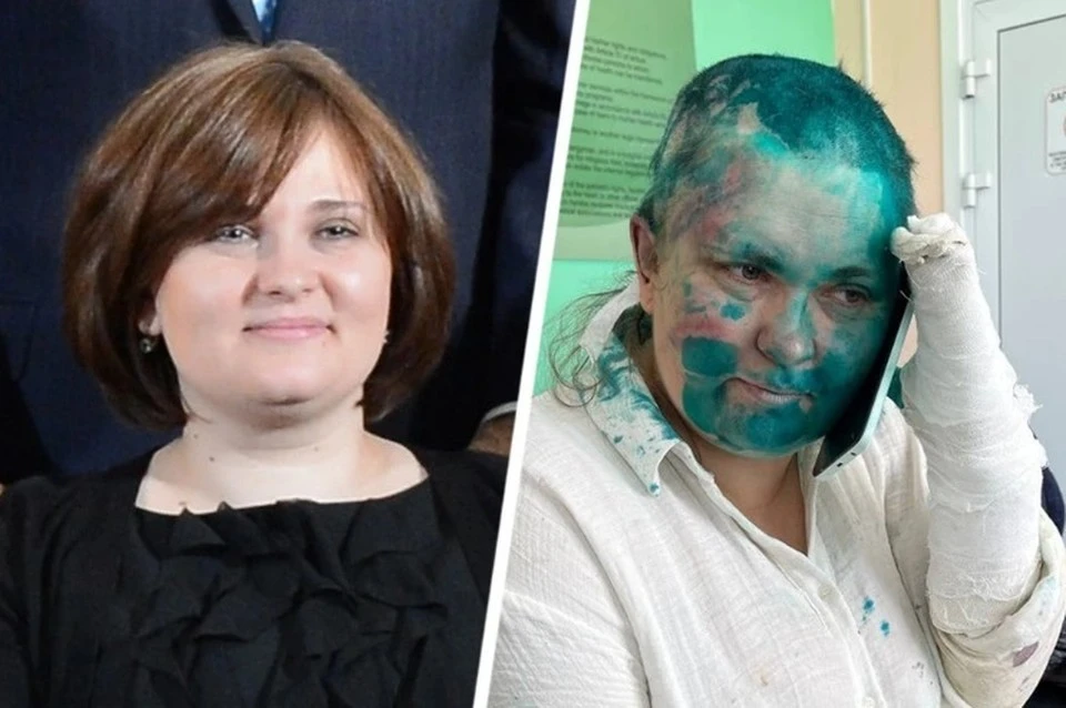 «Чувствует себя лучше»: Журналистку Елену Милашину выписали из больницы