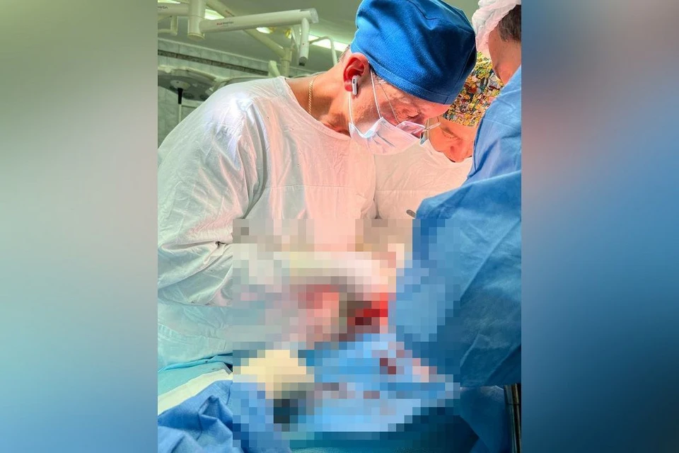 Редчайшую опухоль поджелудочной железы удалили 33-летней женщине в Новосибирске. Фото: Новосибирский онкодиспансер.