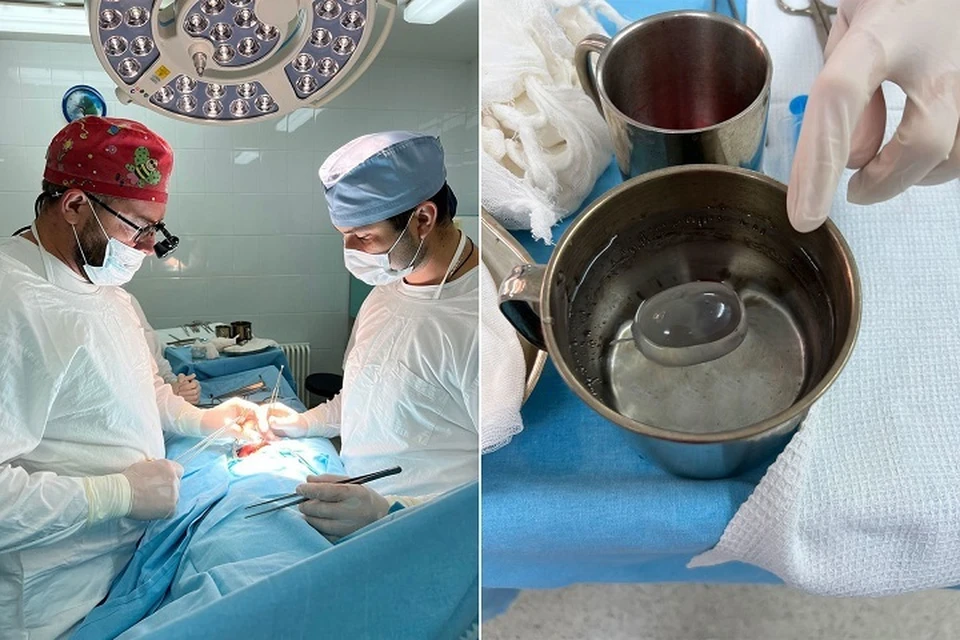 Врачи Клиник СамГМУ начали делать операции по протезированию мошонки