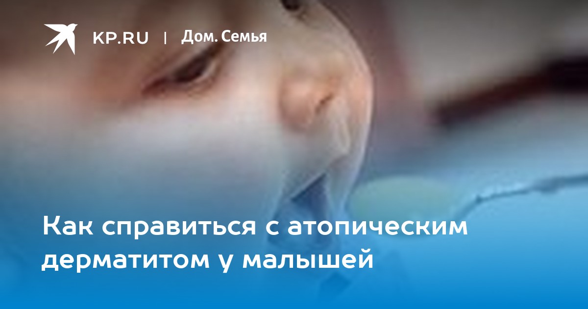 Атопический дерматит | autokoreazap.ru - ВРАЧИ БЕЛАРУСИ