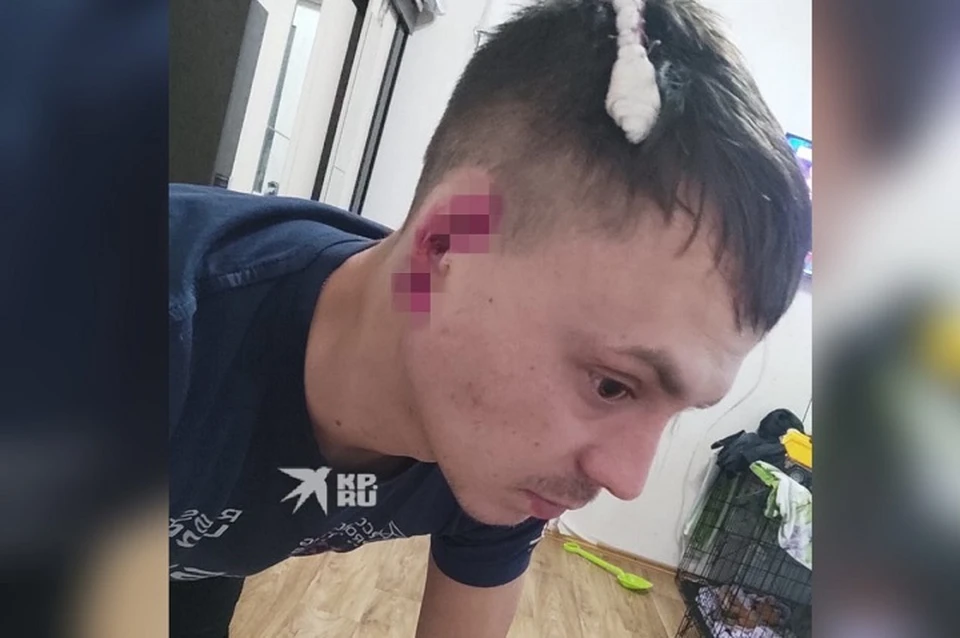 Пока мужчина спасается обезболивающими препаратами. Фото: предоставила Елена Филипова