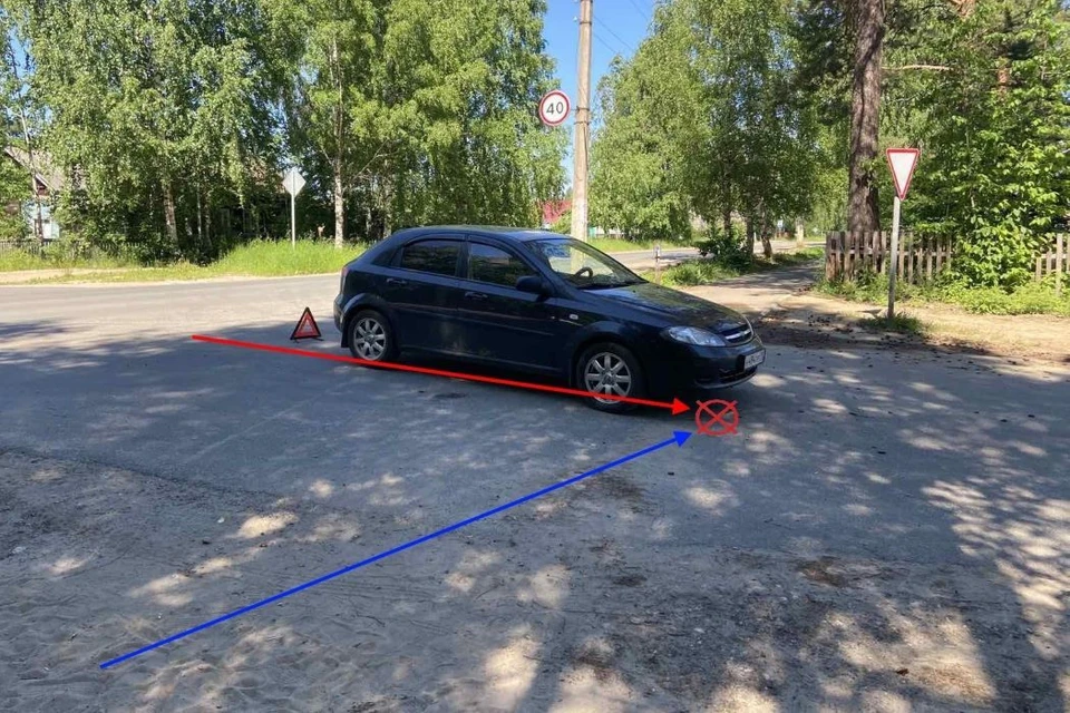 В Сыктывкаре Chevrolet сломал основание черепа велосипедистке