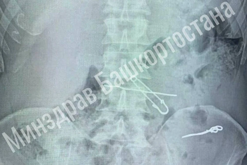 Фото: Минздрав Башкирии