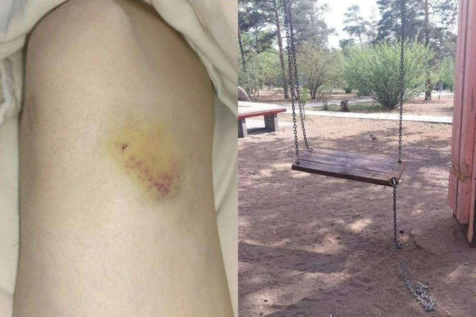 Обычная прогулка по городу обернулась для 15-летней Кати* несчастьем. Фото: личный архив мамы пострадавшей школьницы.