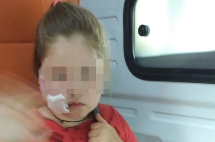 «Искусала все лицо, наложили много швов»: Бойцовская собака набросилась на маленькую девочку в Городце, пока хозяйка стояла в стороне