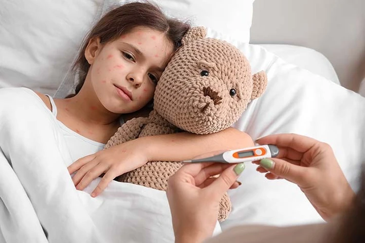 Проявления ветряной оспы у детей: полный перечень симптомов