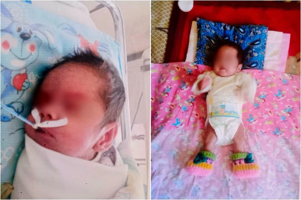 Не могла самостоятельно есть, дышать: как живет девочка, весившая при рождении не больше пачки сахара. Фото: ДРКБ.