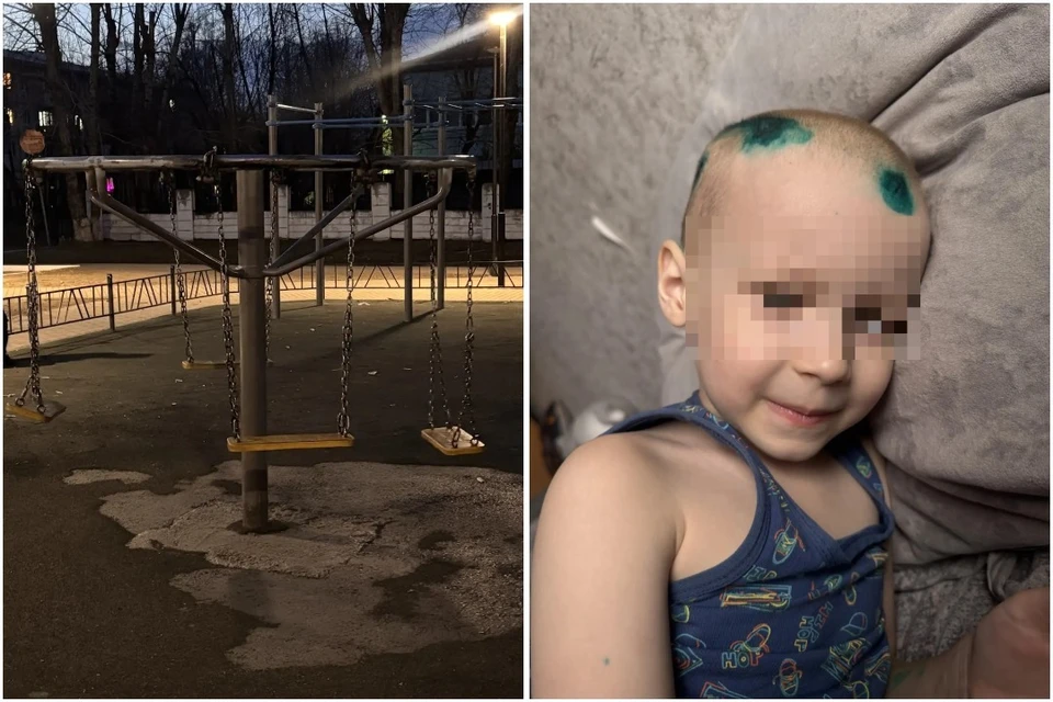 6-летнего мальчика ввели в кому после того, как на него упали качели. Фото: личный архив.