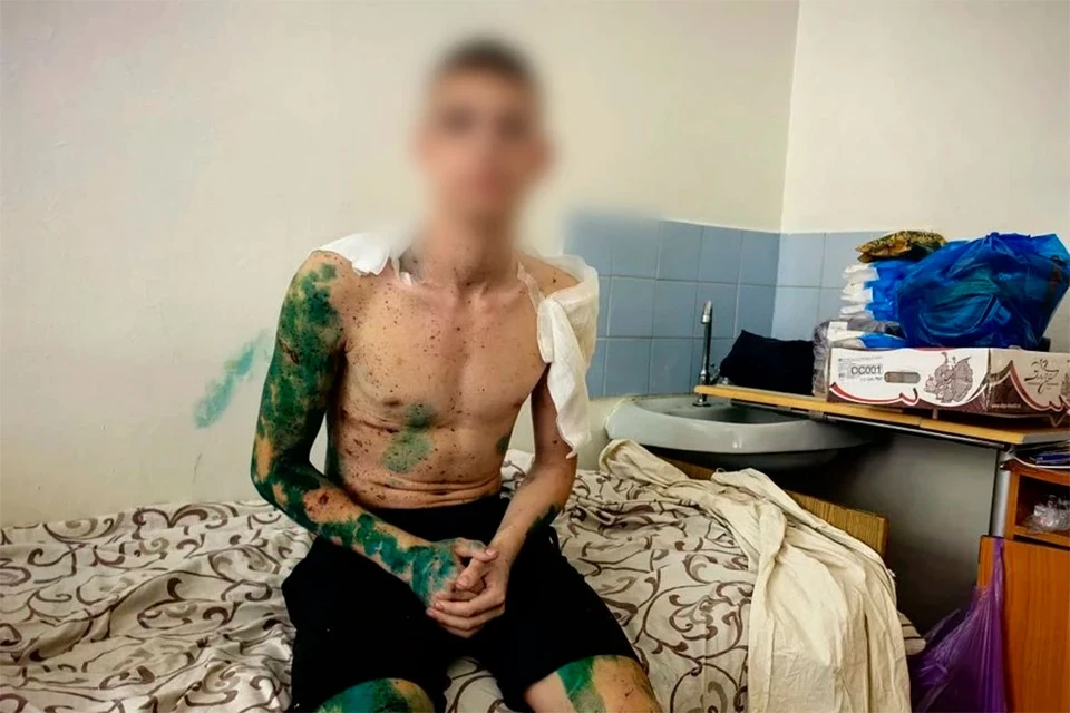 Студент при ударе ВСУ по Старобельску упал с пятого этажа и чудом выжил.