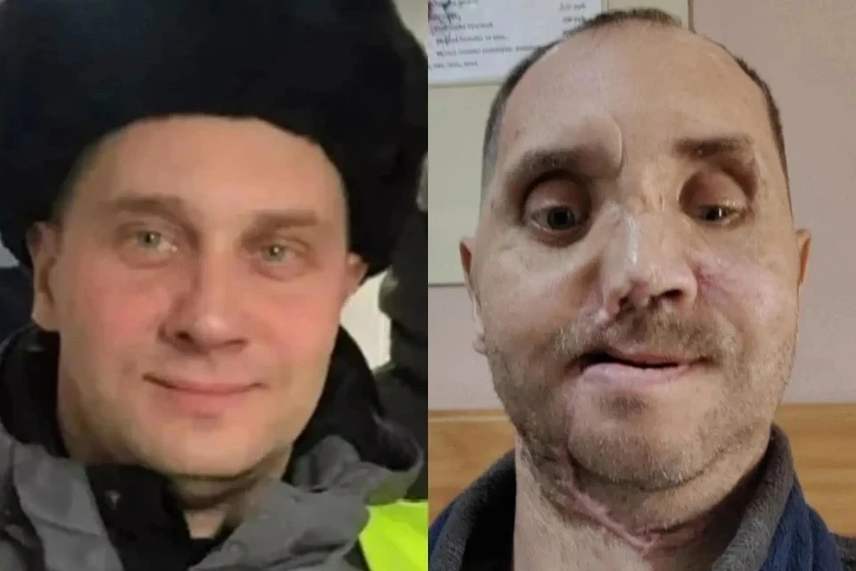 Виталий до и после аварии - это будто два разных человека