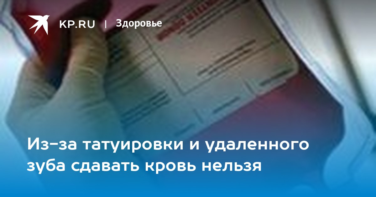 Сдача крови после удаления зуба. Можно сдавать кровь после удаления зуба. Донорство крови после удаления зуба. Когда можно сдавать кровь на донорство после удаления зуба. Сдать кровь после тату