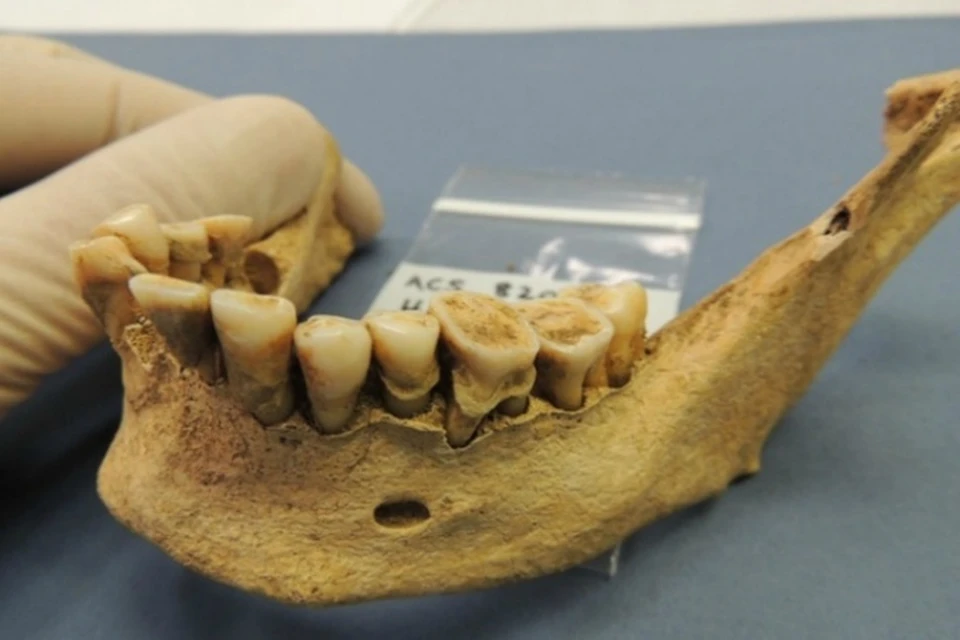 Как в Средние века ухаживали за зубами?