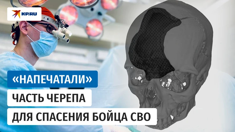Врачи госпиталя восстановили череп офицера российской армии