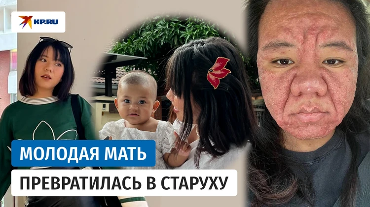 Девушка состарилась на десятки лет во время беременности