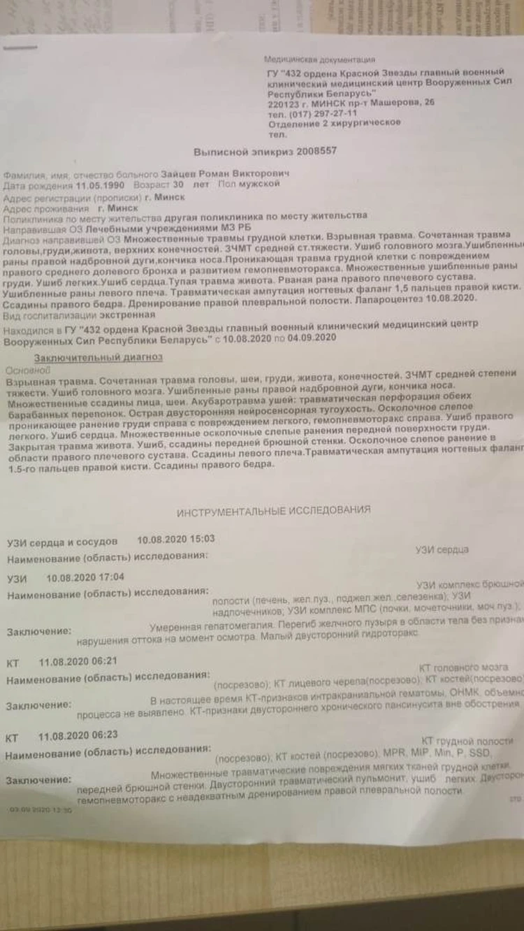 Врачи давали очень мало шансов на то, что я выживу». Мужчина, сильно  травмированный 9 августа светошумовой гранатой, уже выписан из больницы -  KP.RU