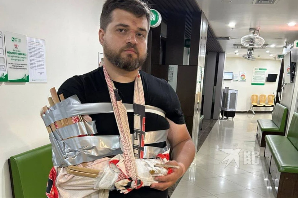 Павел сломал плечо во время поездки на мотоциклах. Фото: предоставил брат мужчины